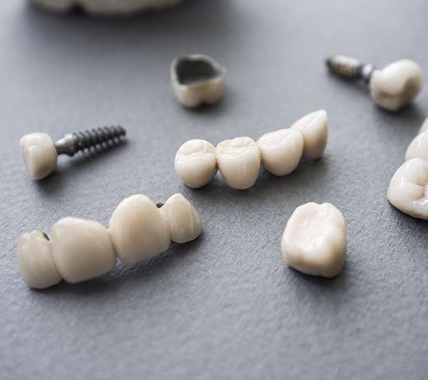 Killeen The Difference Between Dental Implants and Mini Dental Implants